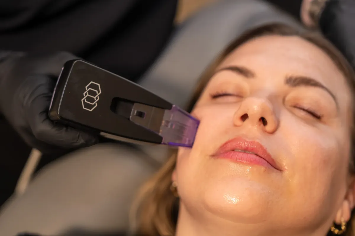 Woman with smooth rejuvenated skin after Morpheus8 RF microneedling recovery at Eternal Wellness Medical Spa in Traverse City MI