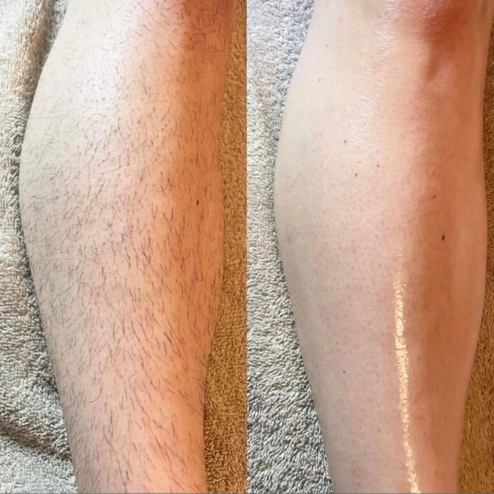 Spa Waxing - Before and After