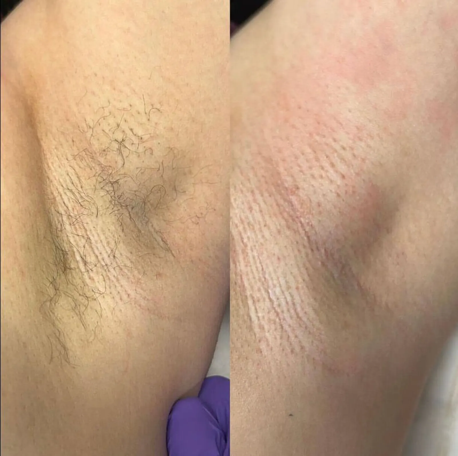 Spa Waxing - Before and After