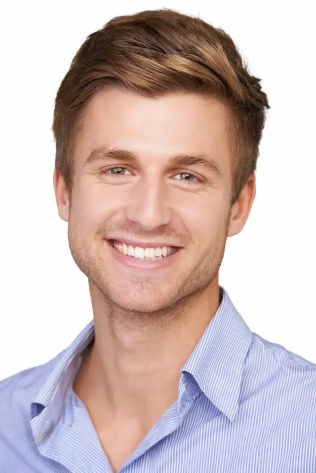 Before and after Carbon Laser Facial results showing improved skin clarity and texture