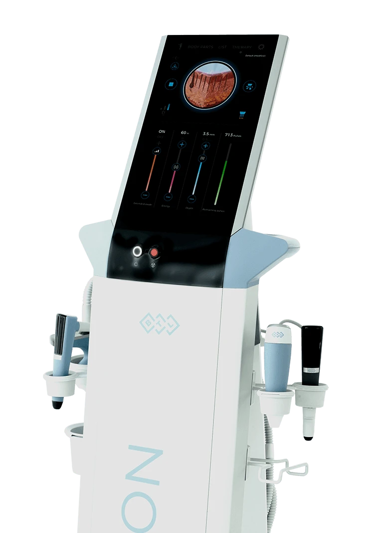 Patient consultation for Exion Clear RF at Eternal Wellness Medical Spa Traverse City