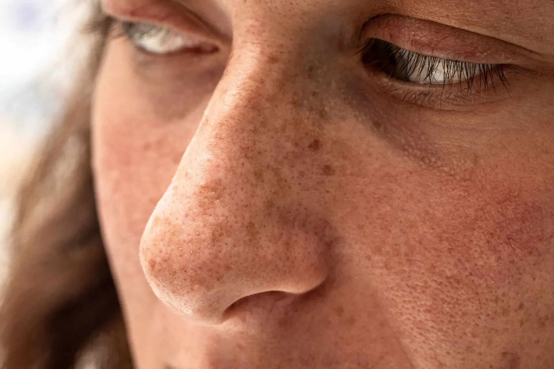 Woman examining hyperpigmentation on her skin at Eternal Wellness Medical Spa Traverse City