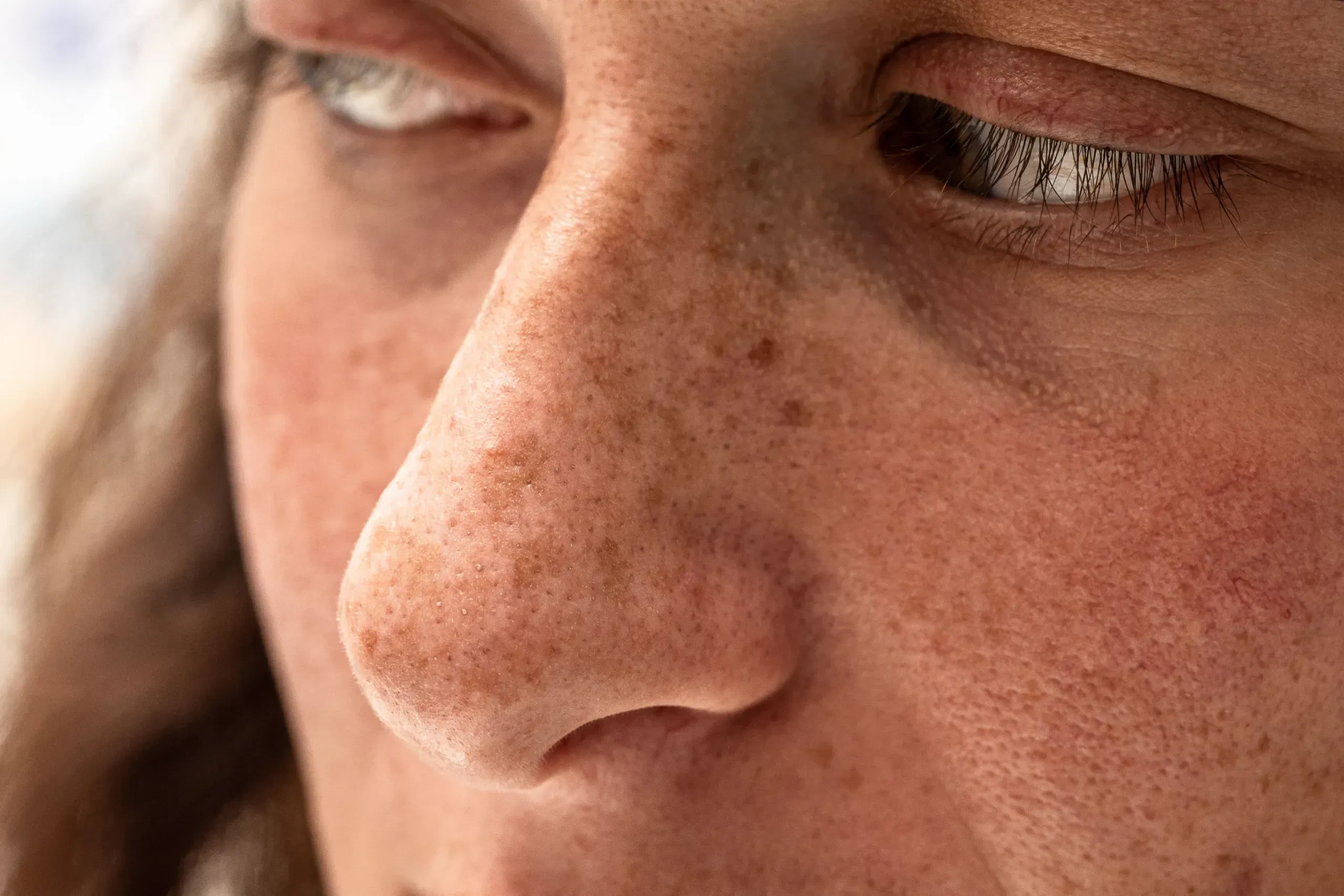 Woman with clear radiant skin after hyperpigmentation treatment at Eternal Wellness Medical Spa in Traverse City MI