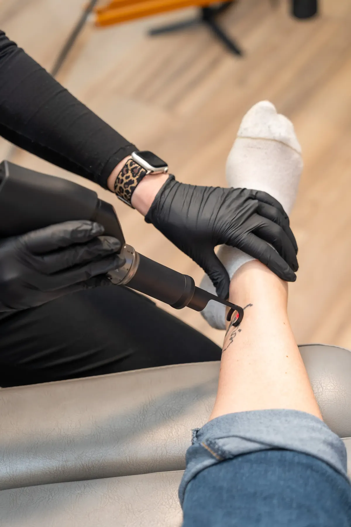 Deka TORO Q-switched Nd:YAG laser device used for tattoo removal at Eternal Wellness Medical Spa