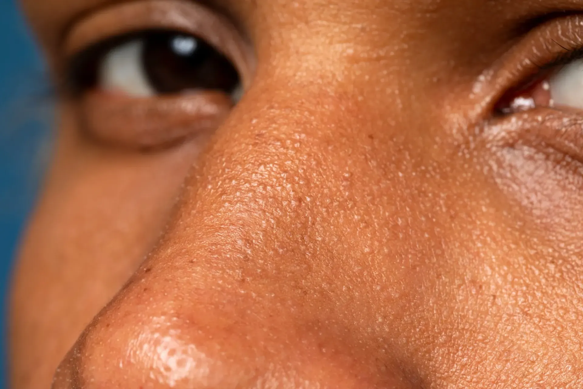 Visual diagram showing the six primary causes of oily skin and enlarged pores