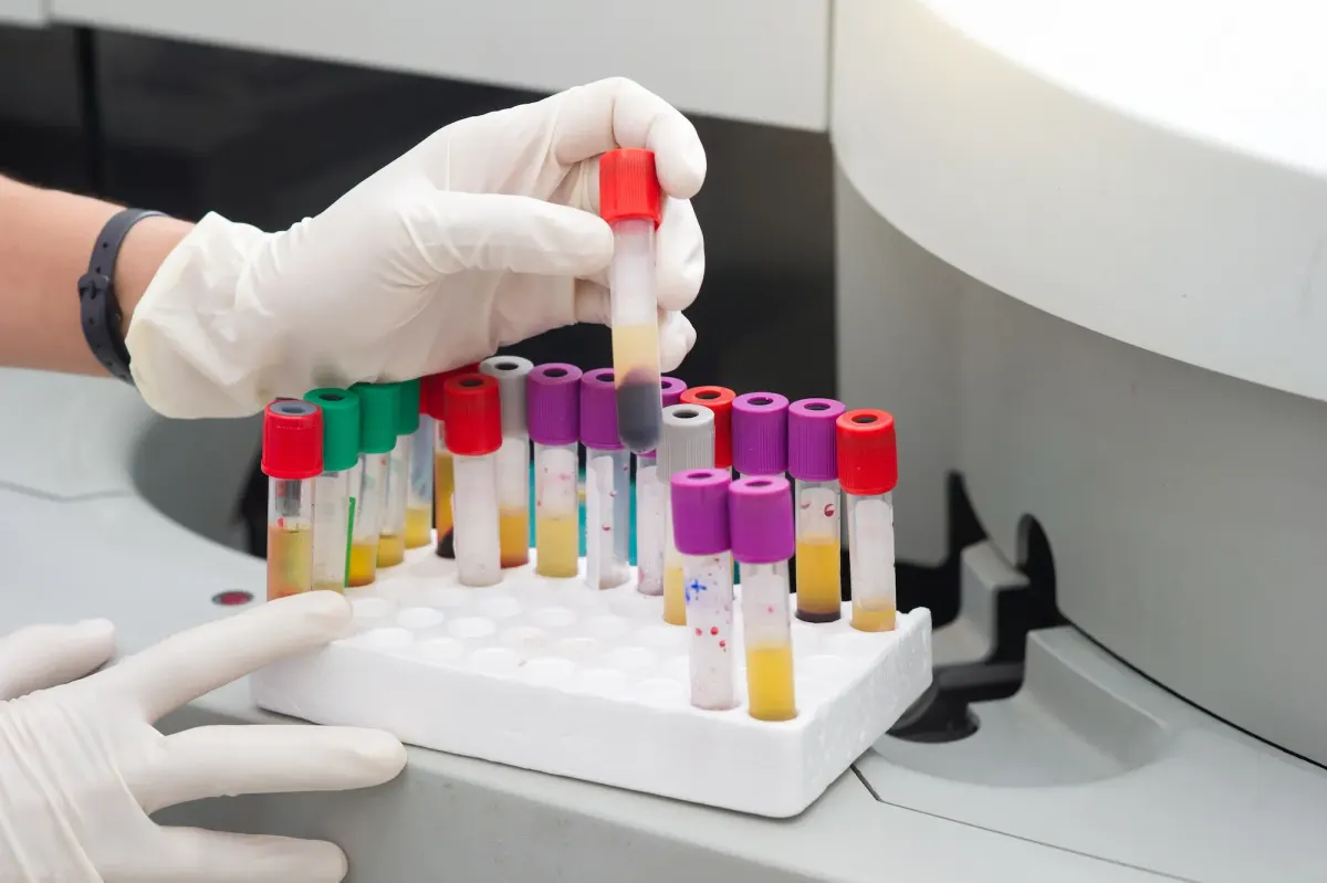 PRP and PRF treatment at Eternal Wellness Medical Spa in Traverse City MI