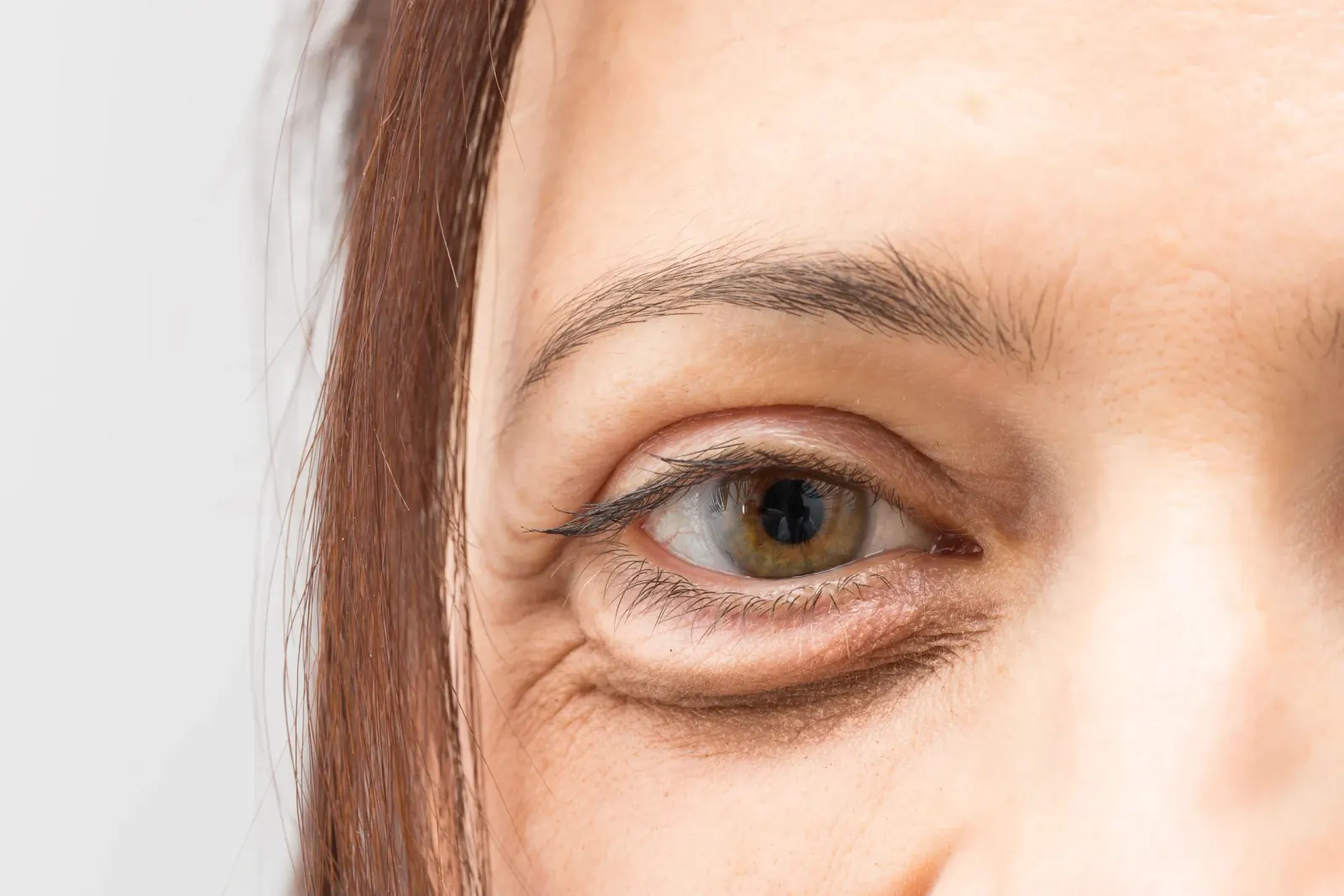 Illustration of collagen breakdown and wrinkle formation at Eternal Wellness Medical Spa Traverse City
