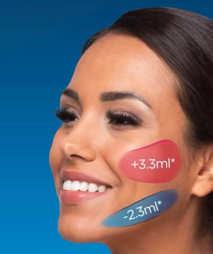 Emface facial volume effect